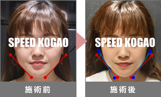 横浜ビブレ店 公式 Speed小顔