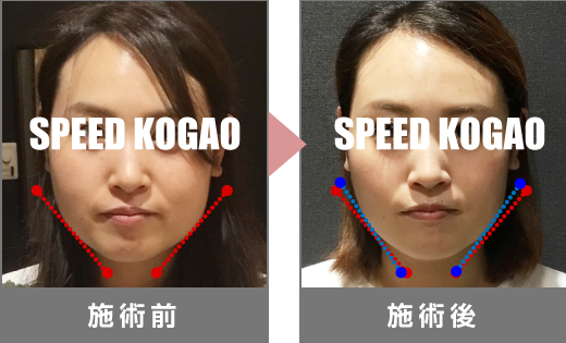 横浜ビブレ店 公式 Speed小顔 横浜ビブレ店 公式 Speed小顔