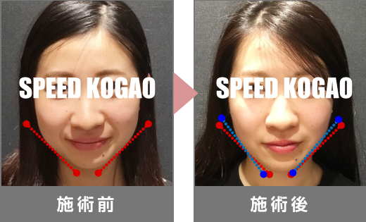 横浜ビブレ店 公式 Speed小顔